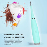 ULTRASONIC STAIN REMOVER