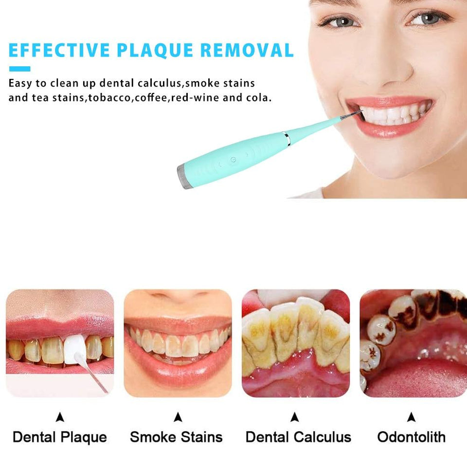 ULTRASONIC STAIN REMOVER