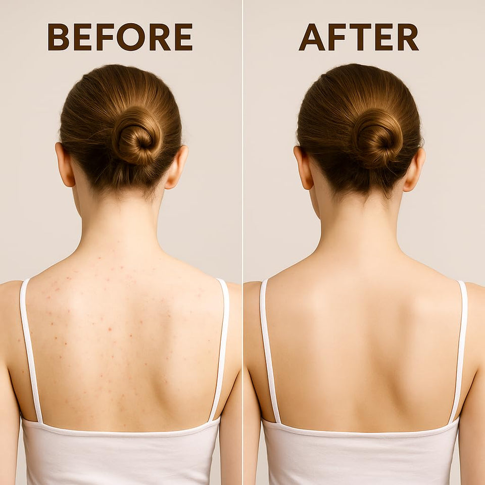 GlowMist™ Peel Shot Spray