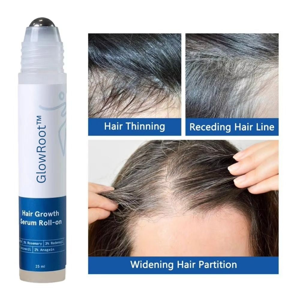 GlowRoot™ Precision Hair Regrowth Serum Roll-On – Glow Tulip