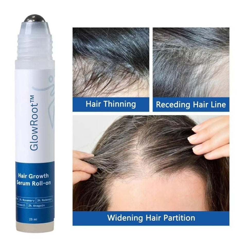GlowRoot™ Precision Hair Regrowth Serum Roll-On