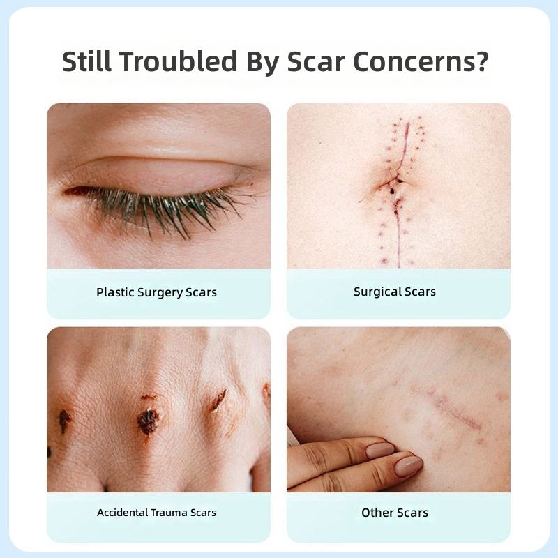 GlowTips Scar Fade Gel