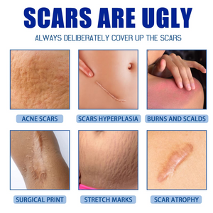 GlowTips Silicone Scar Gel