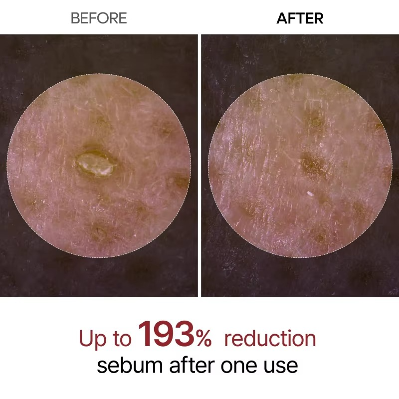 GlowRice™ Peel Shot