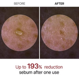 GlowRice™ Peel Shot
