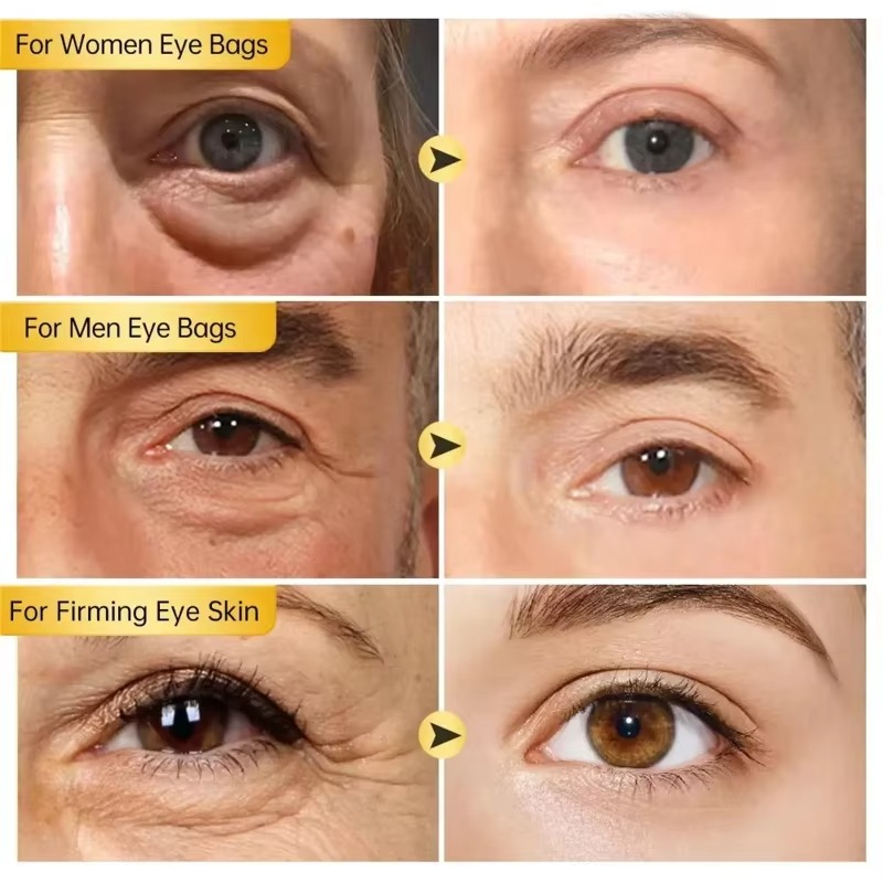 Instant Eye Tightener