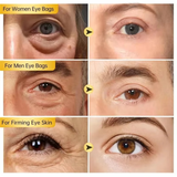 Instant Eye Tightener