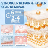 GlowTips Silicone Scar Gel