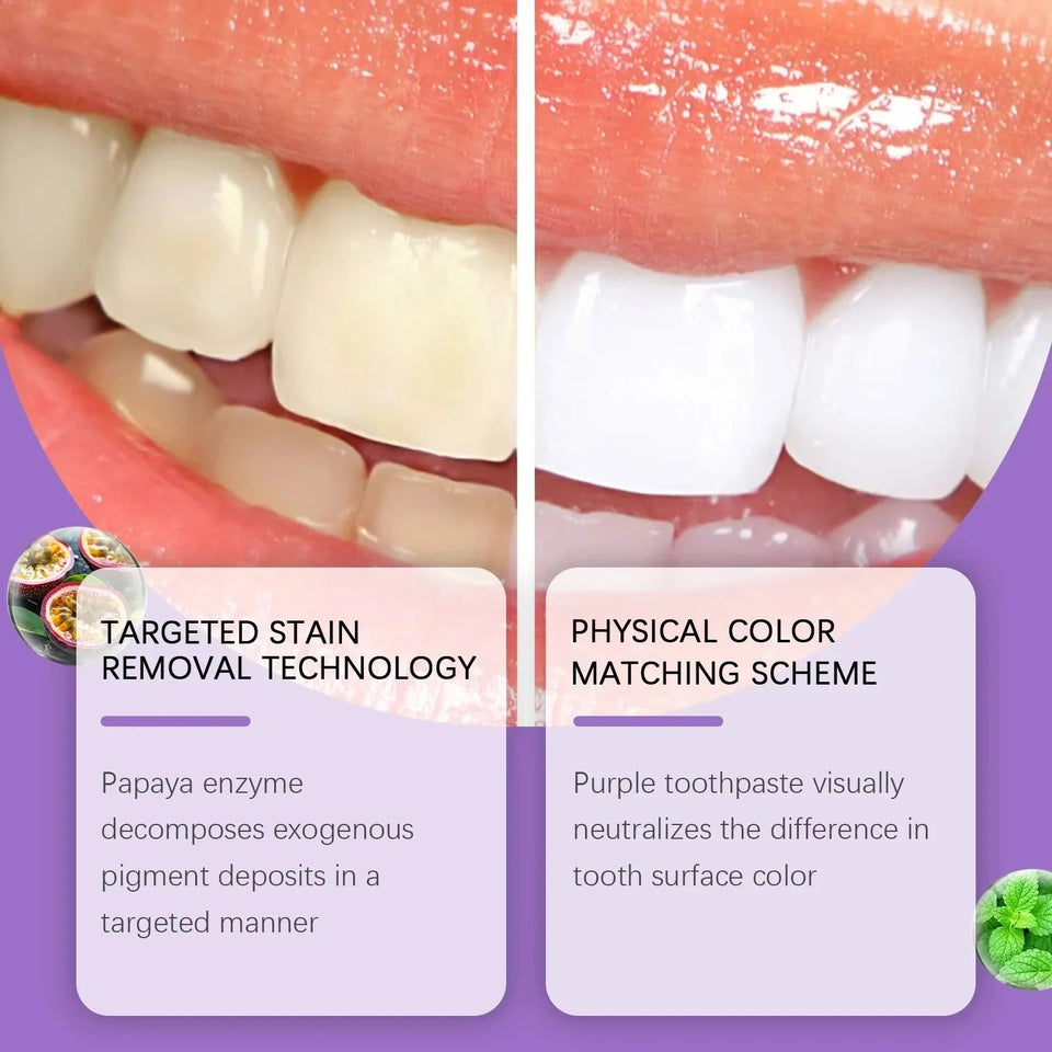 Teeth Whitening Strips