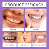 Teeth Whitening Strips