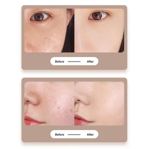 MoleAway Pro